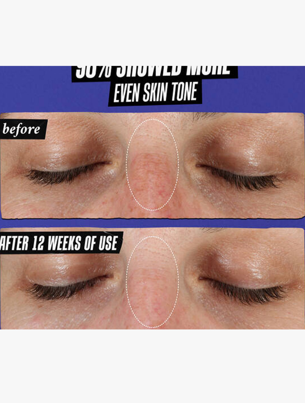 Clearly Corrective Dark Spot Solution 30 ml thumbnail 2